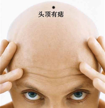 男人的福痣和禍痣 男人的福痣和禍痣